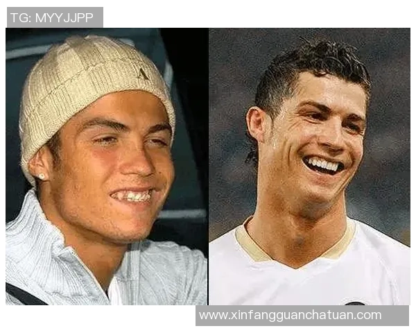 足球明星正畸前后对比图集揭秘他们的微笑变化与魅力提升 足球明星正畸前后对比图集揭秘他们的微笑变化与魅力提升